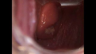 Avy Нээлттэй Pussy нь Speculum